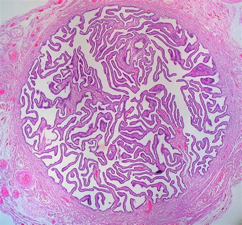 Histology of FALLOPIAN TUBE - MEDizzy