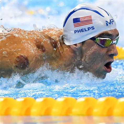 What Is Cupping, and Why Are Olympians Doing It? | Michael phelps ...