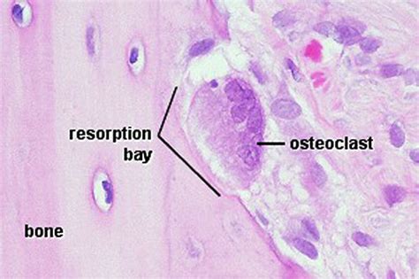 Bone Histology - Embryology