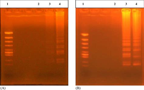 Results of optimization for RT-LAMP condition. (A) Varied temperature:... | Download Scientific ...