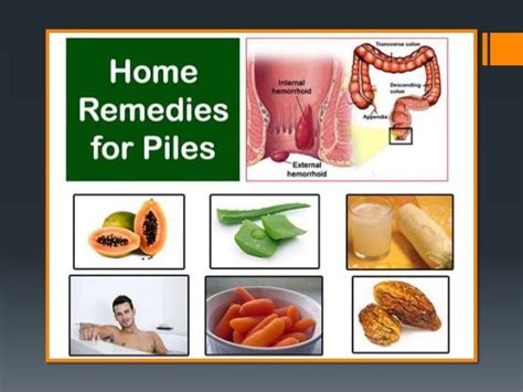 8 home remedies for hemorrhoids