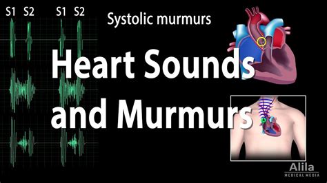 Heart Sounds and Heart Murmurs, Animation. - YouTube