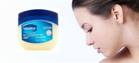 Fact or Fiction: Does Vaseline Really Cause Acne?