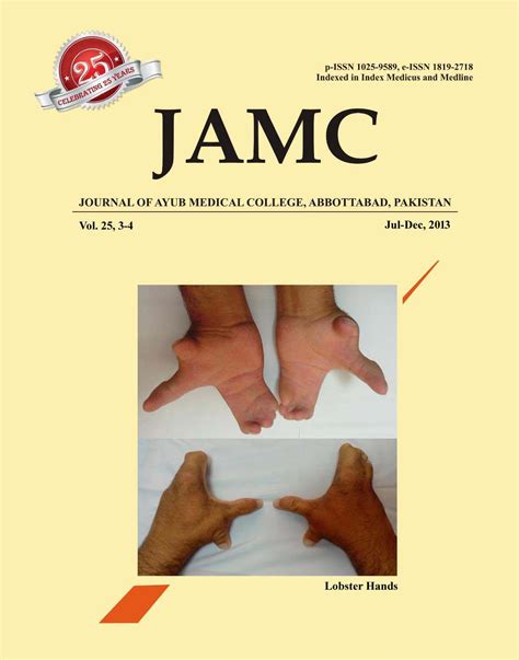 Journal of Ayub Medical College Abbottabad 25(3-4)