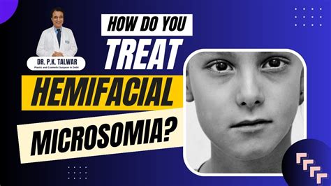 How do you treat Hemifacial Microsomia? Causes, Symptoms & Treatment ...