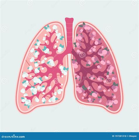 Healthy Lungs Diagram