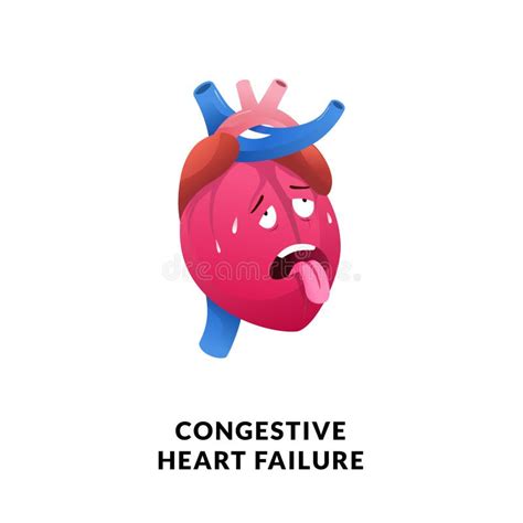 Congestive Heart Failure Cartoon