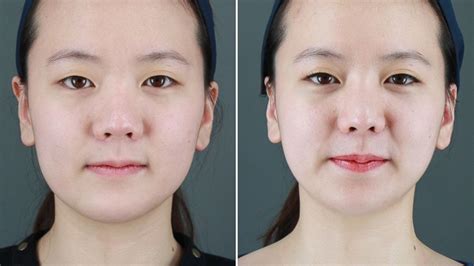 South Korea's Growing Obsession with Cosmetic Surgery - ABC News