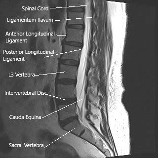 Spinal Cord Anatomy Cauda Equina