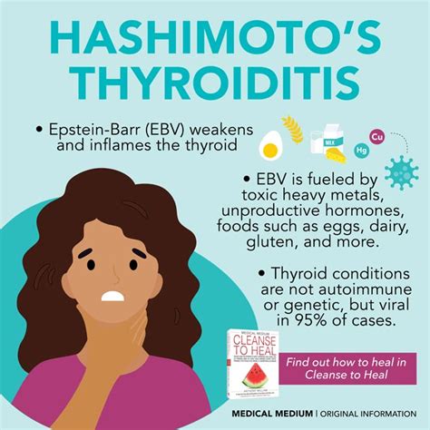 Hashimoto’s Thyroiditis