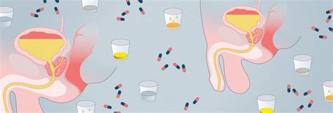 Male UTI Treatment And Testing