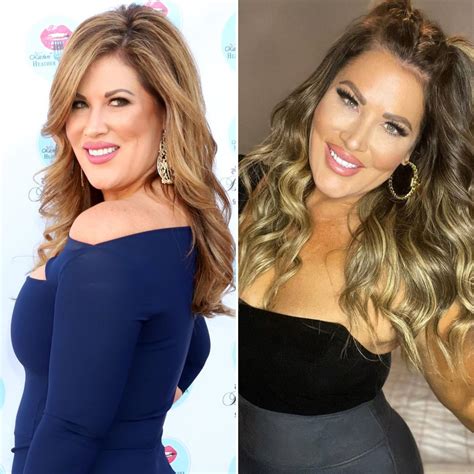 RHOC’s Emily Simpson Reveals She Got a ‘Face’ and ‘Neck Lift’: Plastic ...