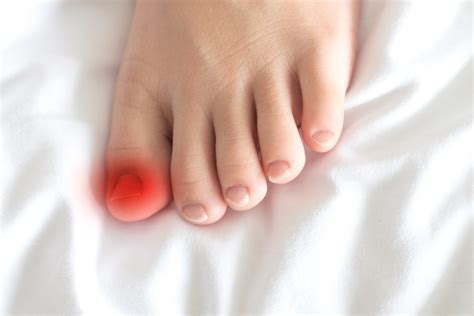 Signs Your Ingrown Toenail is Infected | Southwest Florida Podiatrist