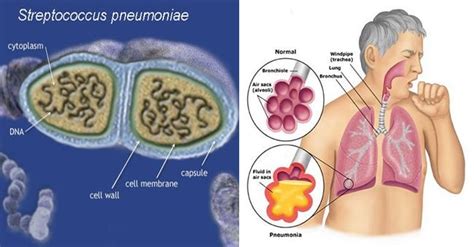 Habitat and Morphology of Streptococcus pneumoniae