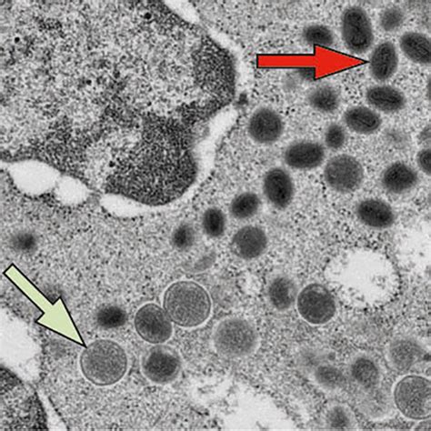 Electron Microscope Images Virus