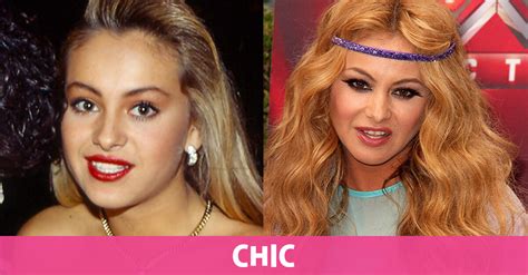 50 famosos, antes y después de la cirugía - Chic