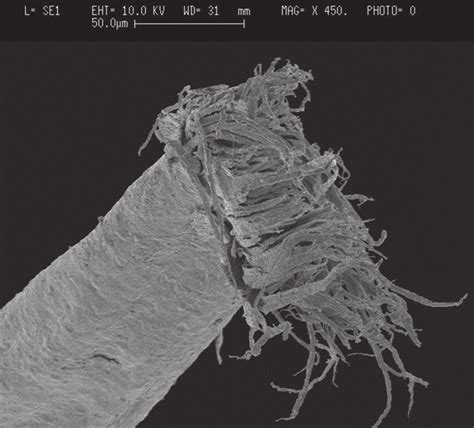 —Trichorrhexis nodosa under the Scanning Electron Microscope. | Download Scientific Diagram