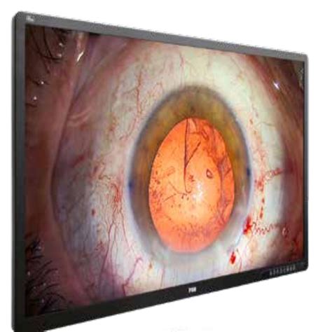 WIDE 55 4K 3D Medical Grade Monitor – Phoenix Medikal