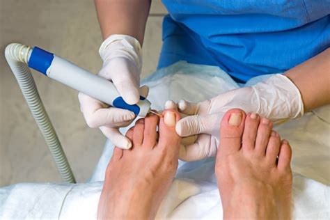 podiatrist home visits near me - adampitch