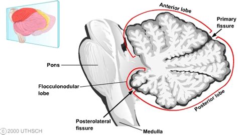 NBME 24 Area labeled ‘E’ (Cerebellum, posterior lobe) (NBME Answers)