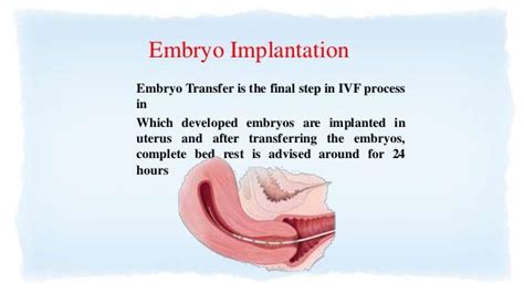 Process of IVF Treatment