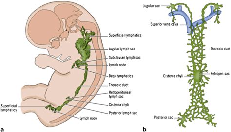 Chyle Leak After Esophageal Surgery | SpringerLink