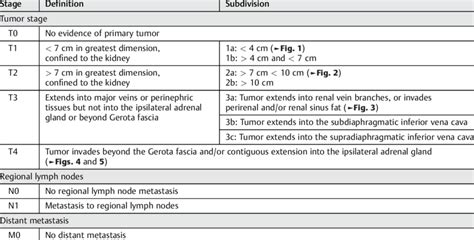 TNM staging for renal cell carcinoma 24 | Download Table