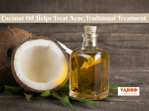 Coconut Oil Helps Treat Acne, Traditional Treatment