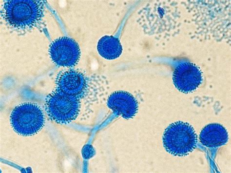 Aspergillus fumigatus - Allergy, Symptoms, & Treatment | Mold Busters