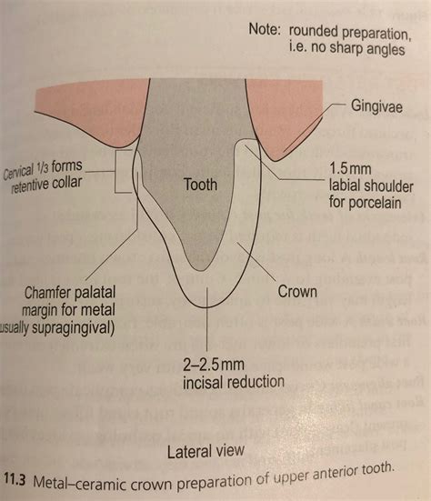 Pin by hanoycedano on Odontología in 2023 | Dental art, Dental surgery ...