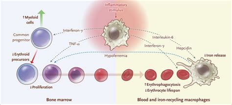 Anemia Of Chronic Disease Hepcidin - Pregnancy Informations