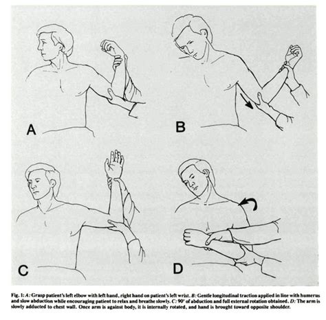 Medicowesome: Reduction Of Anterior Dislocation Of Shoulder, 44% OFF