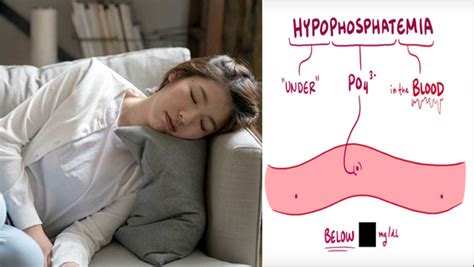 What is Hypophosphatemia?,Low Level of Phosphate in Blood