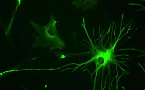 Astrocytes | Facts, Functions, Structure, Types & Repair