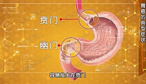 贲门和幽门的位置图,贲门的位置图,幽门的准确位置图_大山谷图库