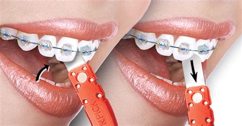 Braces Pain Relief: Flossing with Braces