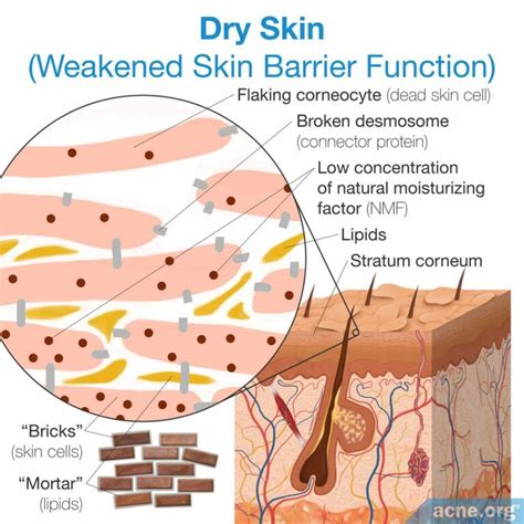 Dry Skin: Causes and Treatments - Acne.org