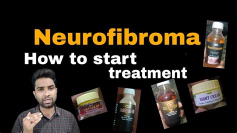 how to start neurofibroma treatment #neurofibroma - YouTube