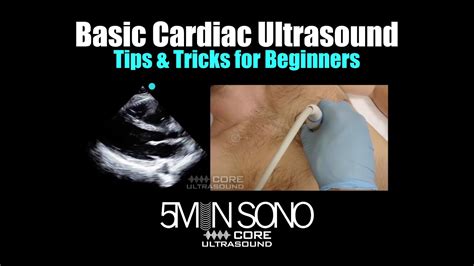 Basic Cardiac Ultrasound: Tips and Tricks for Beginners - YouTube