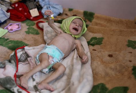 At least 400,000 Yemeni children under 5 could die of starvation this ...