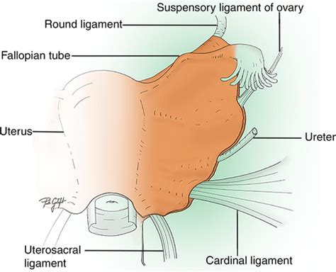 Cardinal Ligament