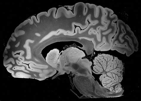 The human brain in 'unprecedented' detail, thanks to powerful MRI | STAT