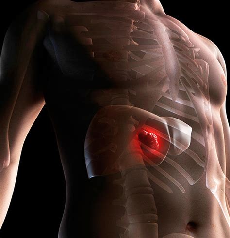 Liver cancer symptoms: Eight signs of the disease - including pain in ...