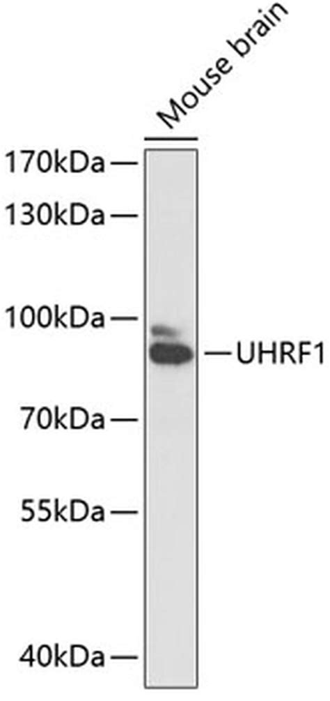 UHRF1 Polyclonal Antibody (PA5-88643)