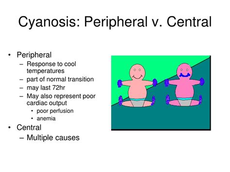 Central Cyanosis Vs Peripheral Cyanosis