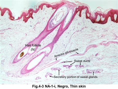 Piloerector Muscle Histology