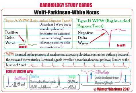 ECG Educator Blog : Wolff-Parkinson-White