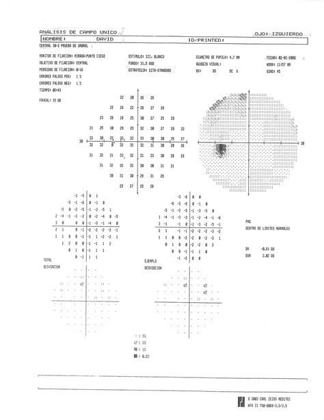 My first follow-up visual field results | FitEyes.com