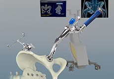 Computer Assisted Hip & Knee Joint Replacement Newport Beach, Misison ...