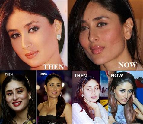 Chatter Busy: Kareena Kapoor Plastic Surgery